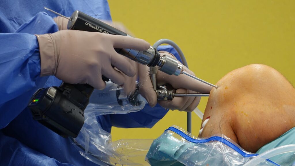 Acl surgeon