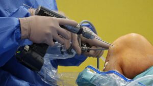 Acl surgeon